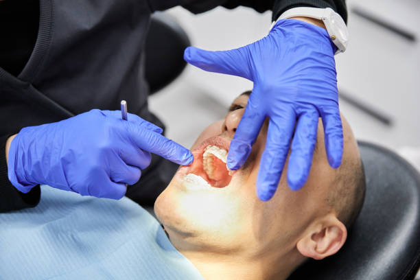 Best Dentist for Tooth Abscess  in Edinboro, PA